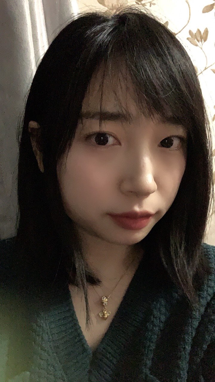 热拉提_整形日记_整形前后对比图_整容效果_新氧整形