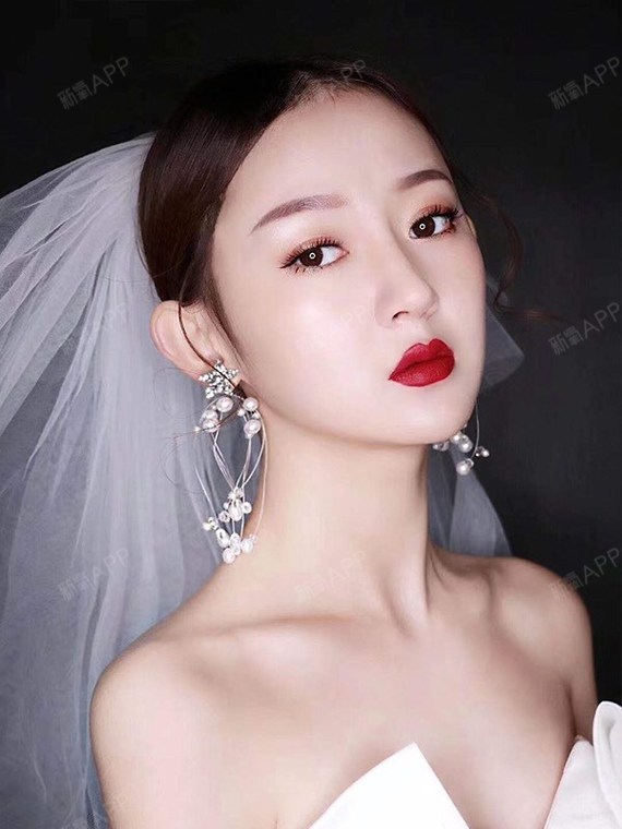 重庆肋软骨隆鼻好不好_效果图_氧气aic4dbe肋软骨隆鼻术后第206天