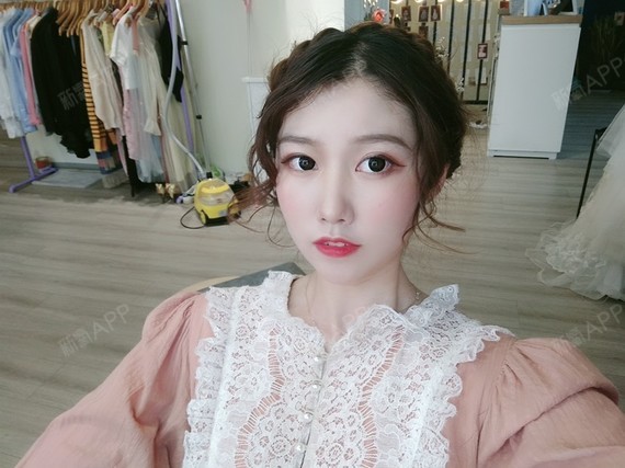 鼻部多项好不好_效果图_懵圈的小胖圆鼻部多项术后第40天_新氧美容