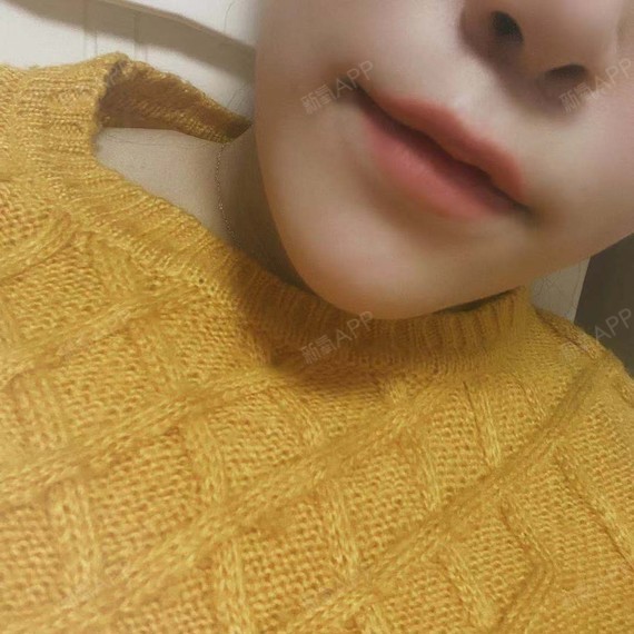人中缩短术后多久完全消肿_人中缩短术后注意事项_人中缩短术后