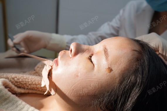 原谅我一直到现在才来更新,很幸运成为朱莎医生的锦鲤,成为了超体隆鼻