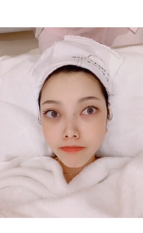 水光补水后 哈哈 皮肤透光的感觉 滑滑嫩嫩的,连敷一_圈子-新氧美容