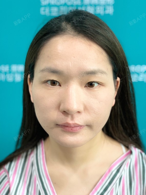 我的头型不大,但是脸大!