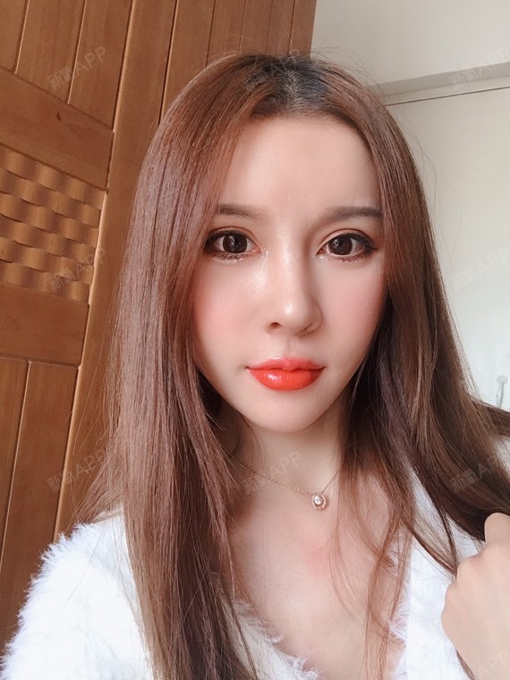 首尔特别下巴吸脂术/去双下巴好不好_效果图_下至日下巴吸脂术/去双