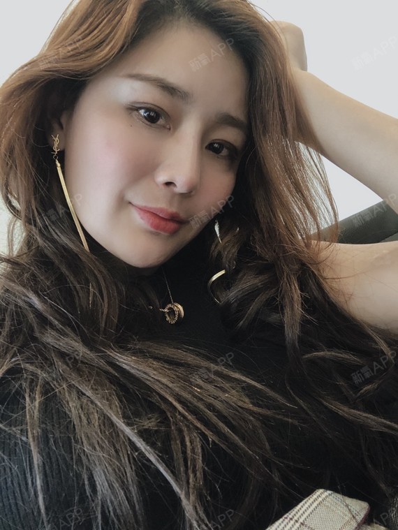 自体脂肪填充全脸