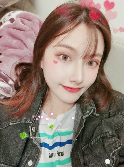 没有随着时间推移脸蛋儿脸部凹陷下去现在脸部还是很饱满的