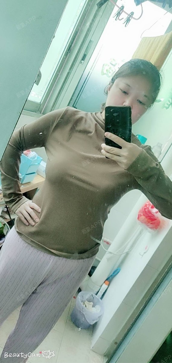 我做了大胸缩小,很多人不明白大胸的烦恼!