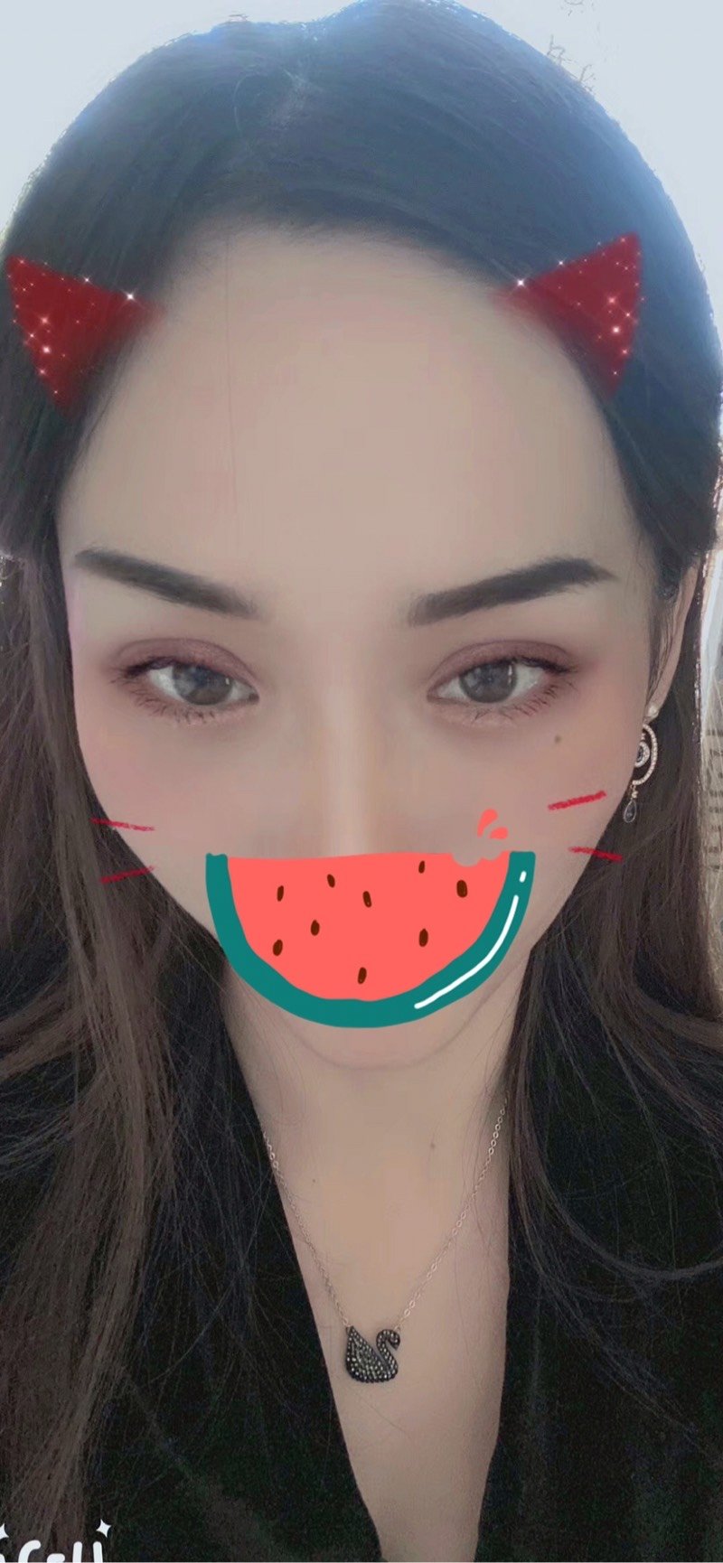 现在我的双眼皮有一个月了哦,眼睛还是恢复的比较好的.