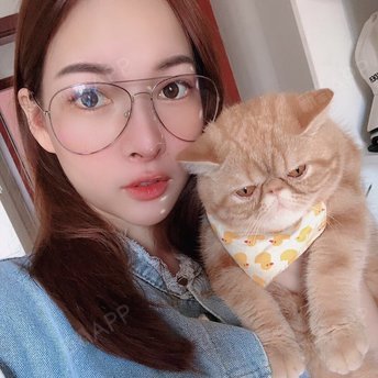 【鼻综合】【送鼻膨体】·刘泳铖院长主刀 硅胶膨体