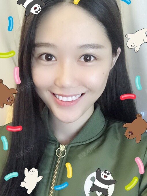 93看看我的纯天然妈生款双眼皮吧～～恢复的还真挺快的_圈子-新氧