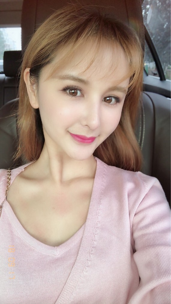 【梦想整形——肋软骨鼻修复】关于做鼻修复的话,肋骨_圈子-新氧美容