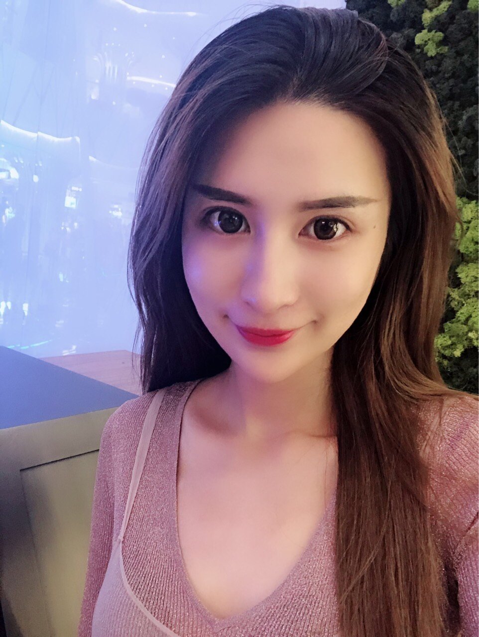 全脸微调整,自体脂肪填充分享让我从丑小鸭变成白天鹅