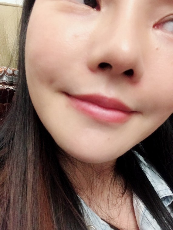 9393#我的酒窝醉迷人#快来帮我点赞呀91左边嘴角的小98窝,是