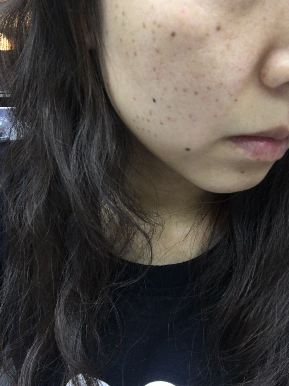 二十多年脸从来没这么干净过!太感动了