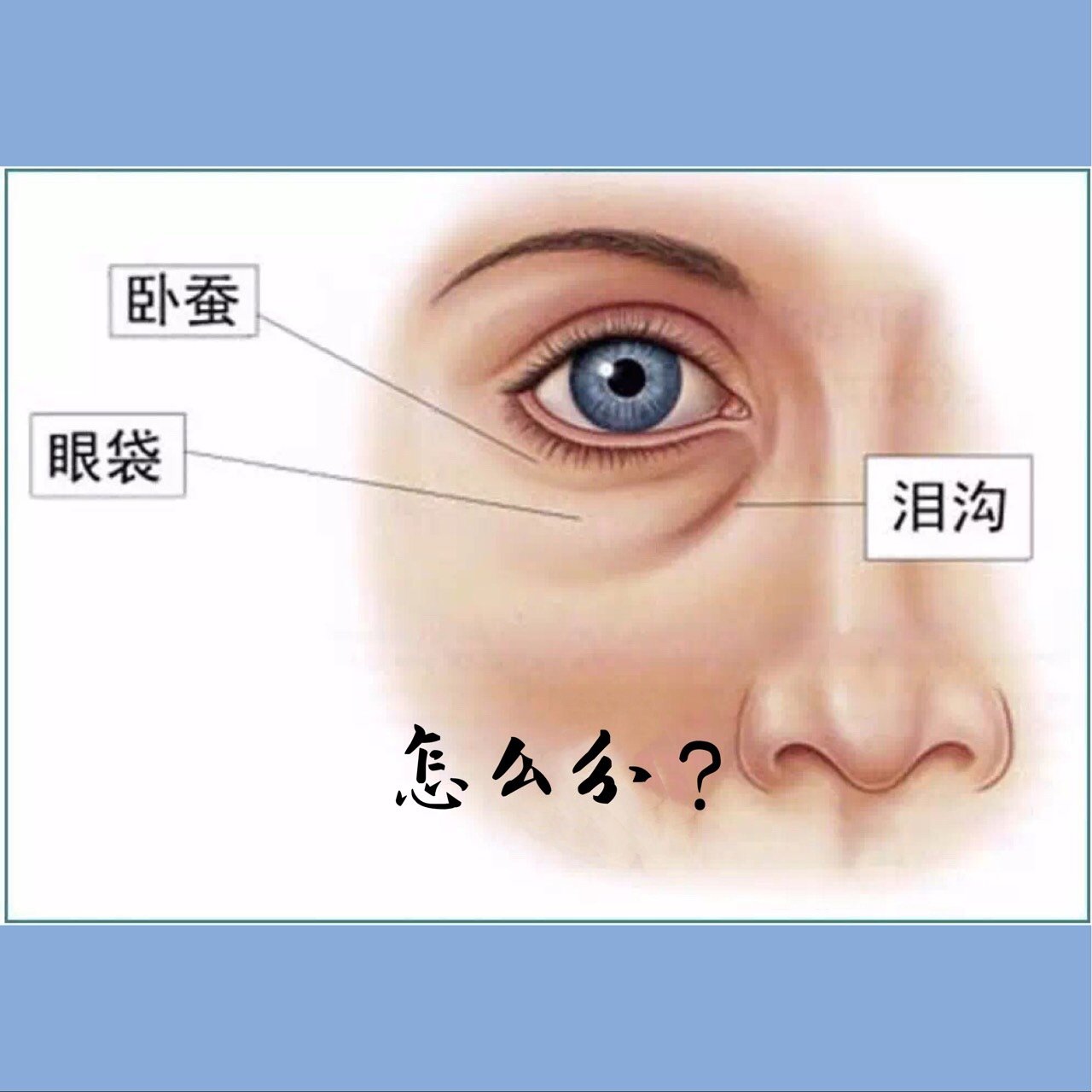 其实卧蚕和眼袋它们的本质性区别就是卧蚕是眼轮匝肌