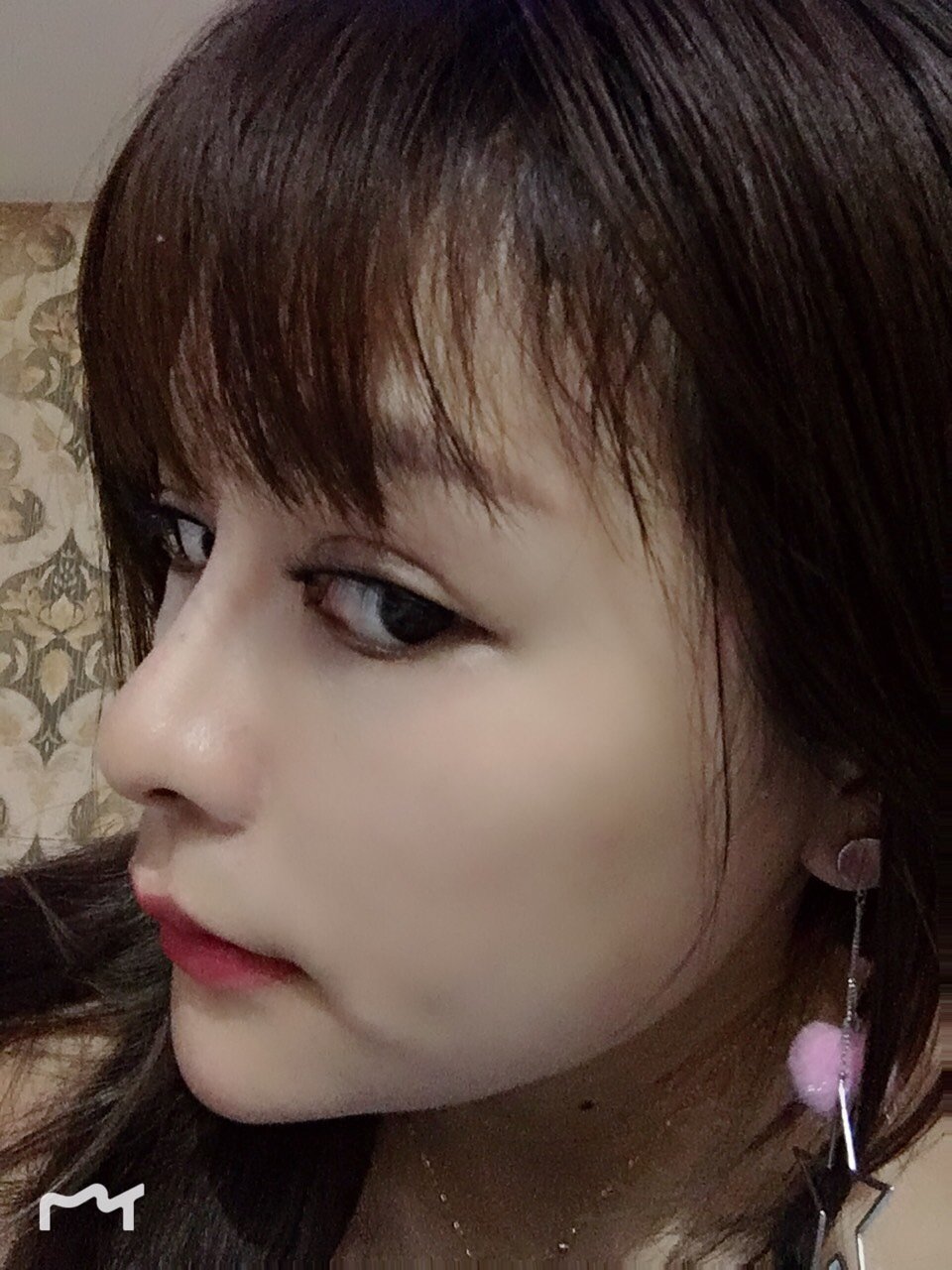 最近看鼻子越来越不顺眼了,感觉鼻翼好大,麻烦达人些给点意见该不该动