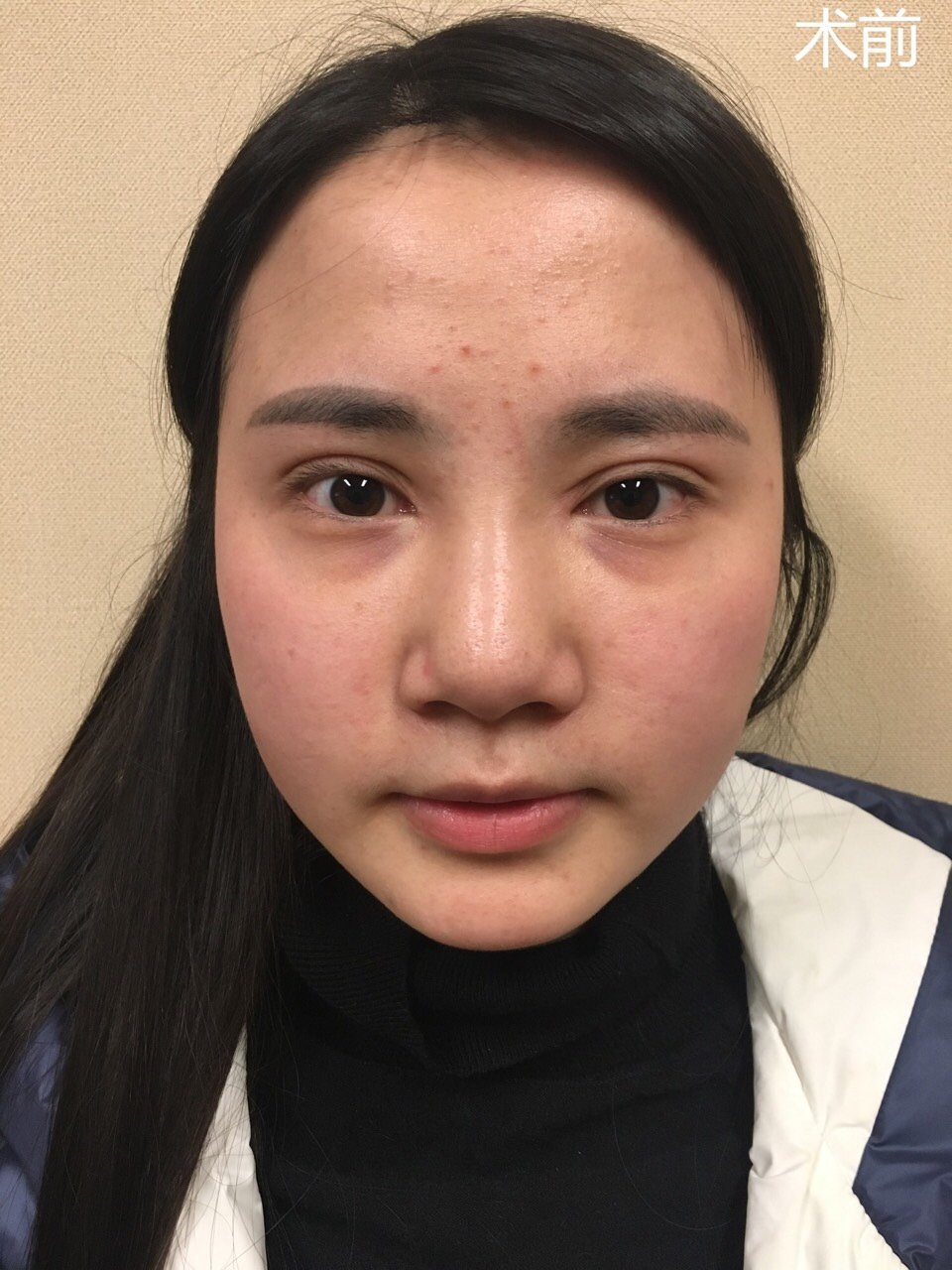 一张"垮脸"毁所有72159696线雕虽然只有几个小小的针_圈子