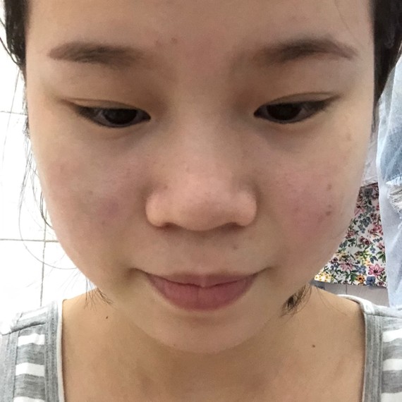 额头大鼻子塌嘴巴还凸,这种侧脸真的好