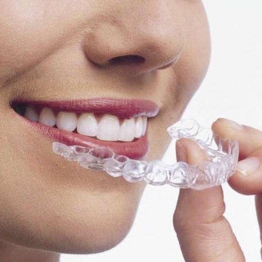 78隐适美第3天打卡