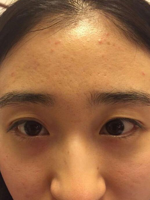 离女神只差一个双眼皮是不是就是这样?