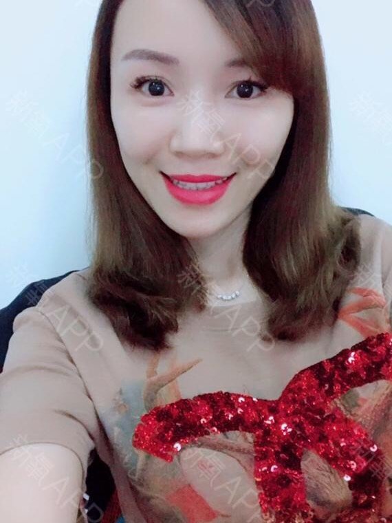 瓷贴面–我的整牙经历