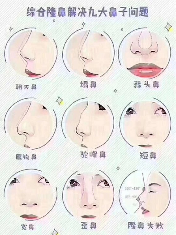 鼻部整形攻略