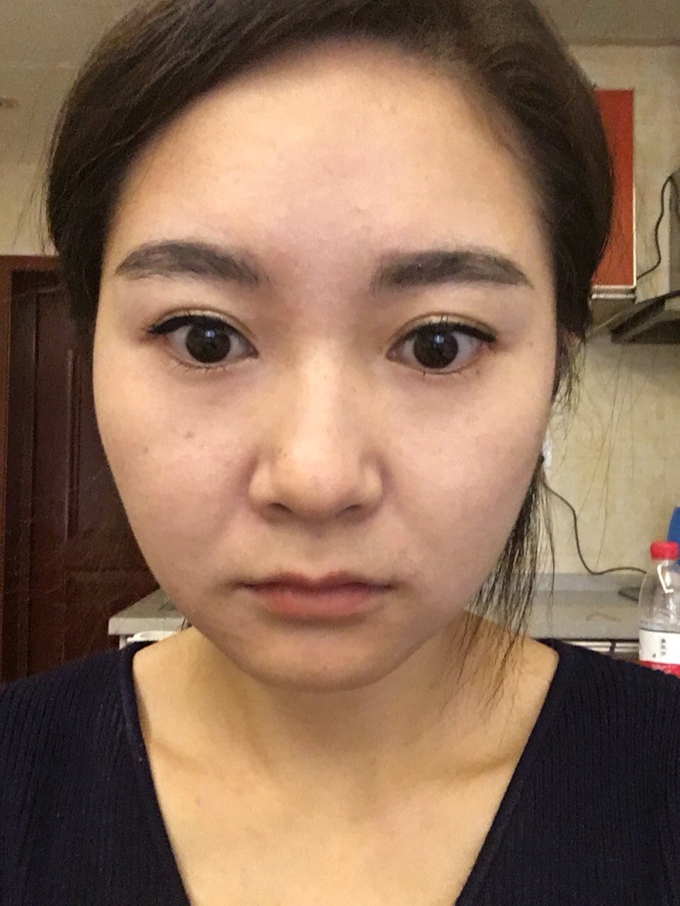 鼻基底凹陷吗,法令纹有点严重哦,28岁.欢迎大家给点意见.