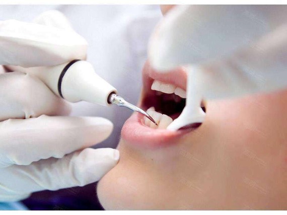 洗牙真的会伤害牙齿吗?