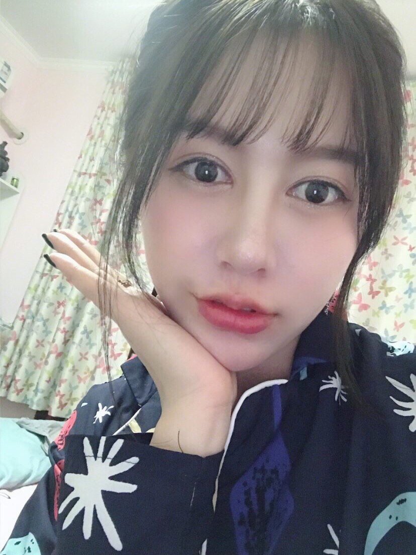 玻尿酸丰唇微笑花瓣唇～乔雅登3号填充～用了一支半形_圈子-新氧美容