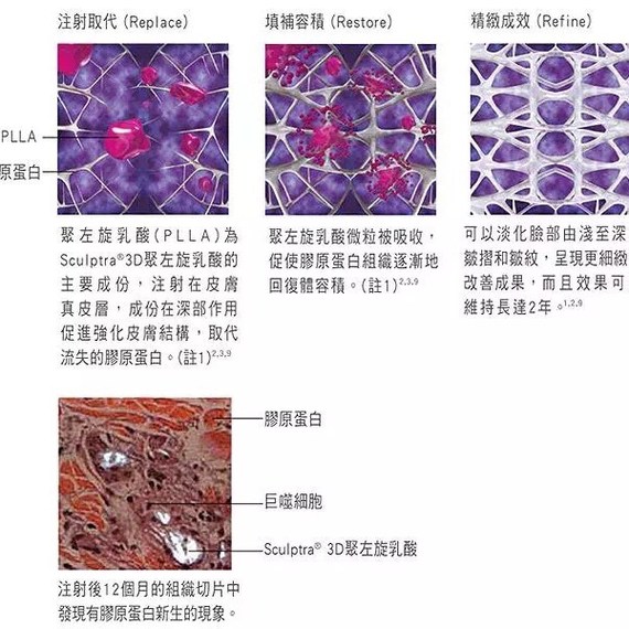 ppdo?pcl?plla?傻傻分不清楚?