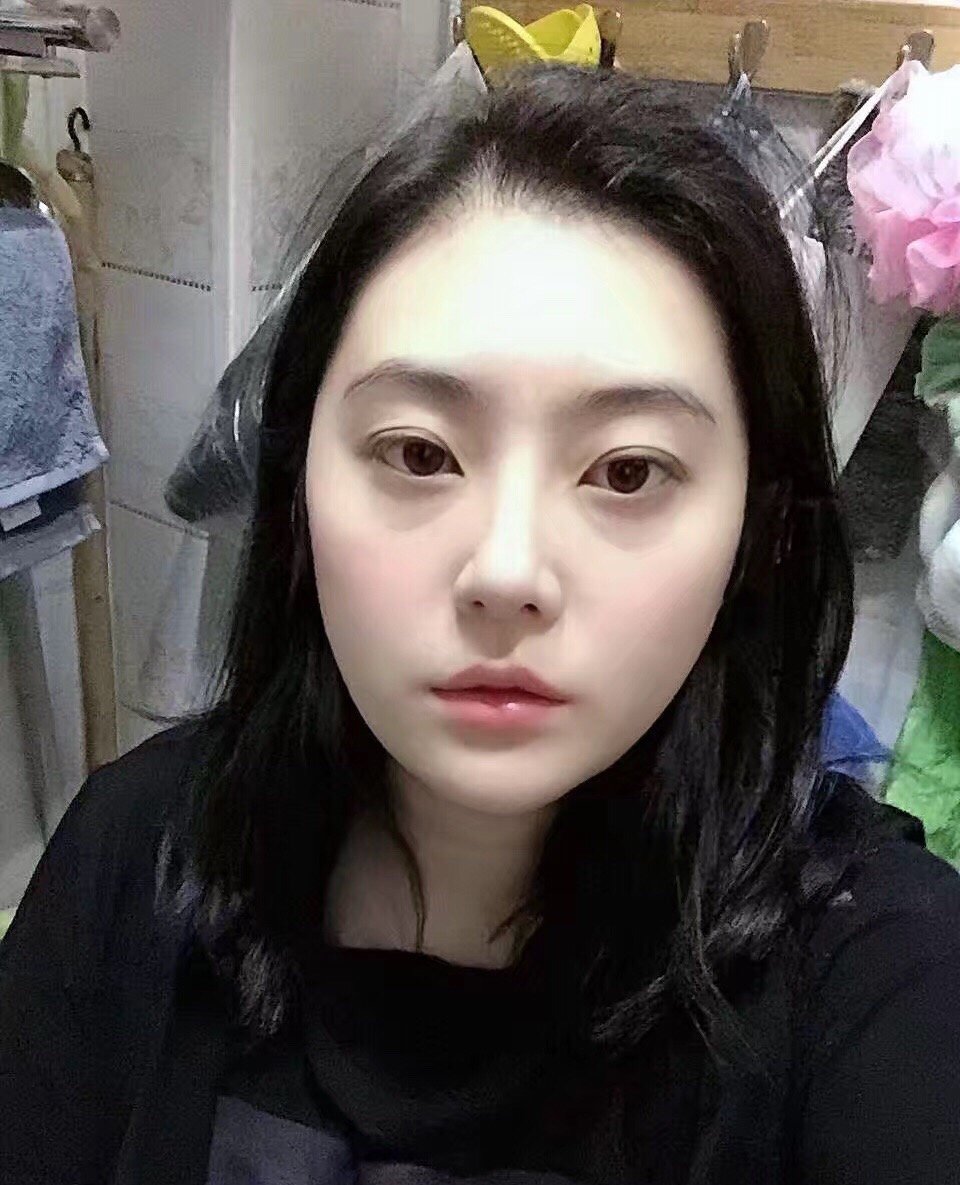 我是新氧APP整形医生夏建军,南京美莱医疗美