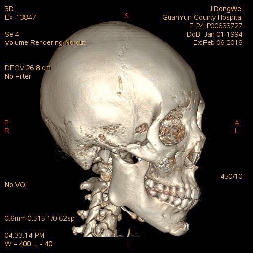 78面部ct到底一年可以拍几次才会不影响我们的身体7178宝宝们