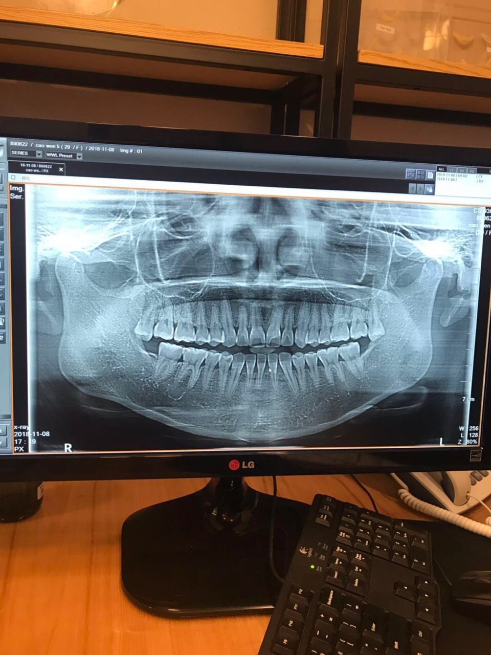 就是轮廓医院,但是重点是,在韩国,你不能用别家的ct,在这家医院面诊