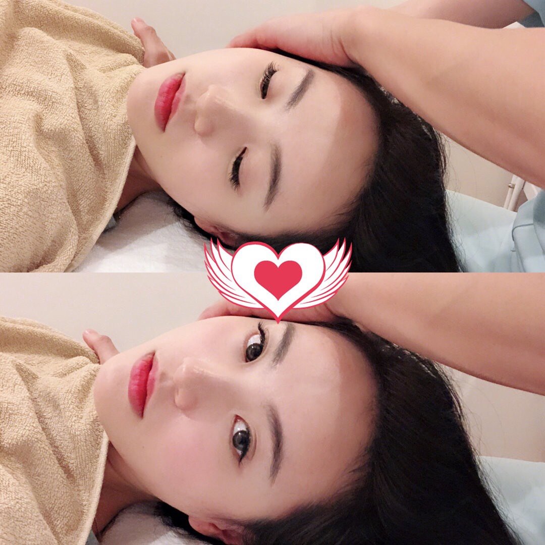 日式小颜矫正 原来你是这样的整骨术
