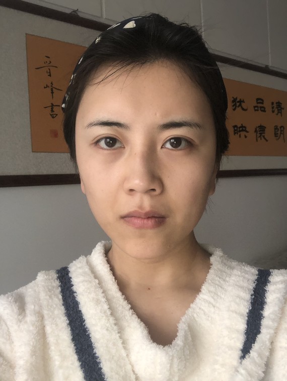 楊醫生,我26歲,覺得自己長相偏老氣,沒什麼活力,怎樣改善啊