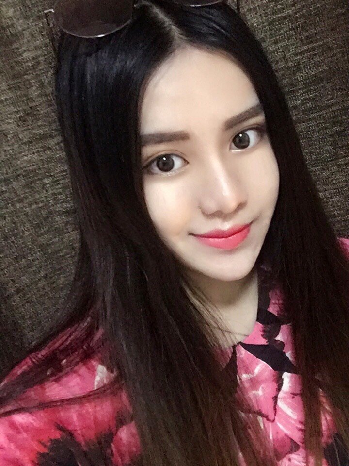 双眼皮形态有7415新月型,7515平行型,7515开扇型等等