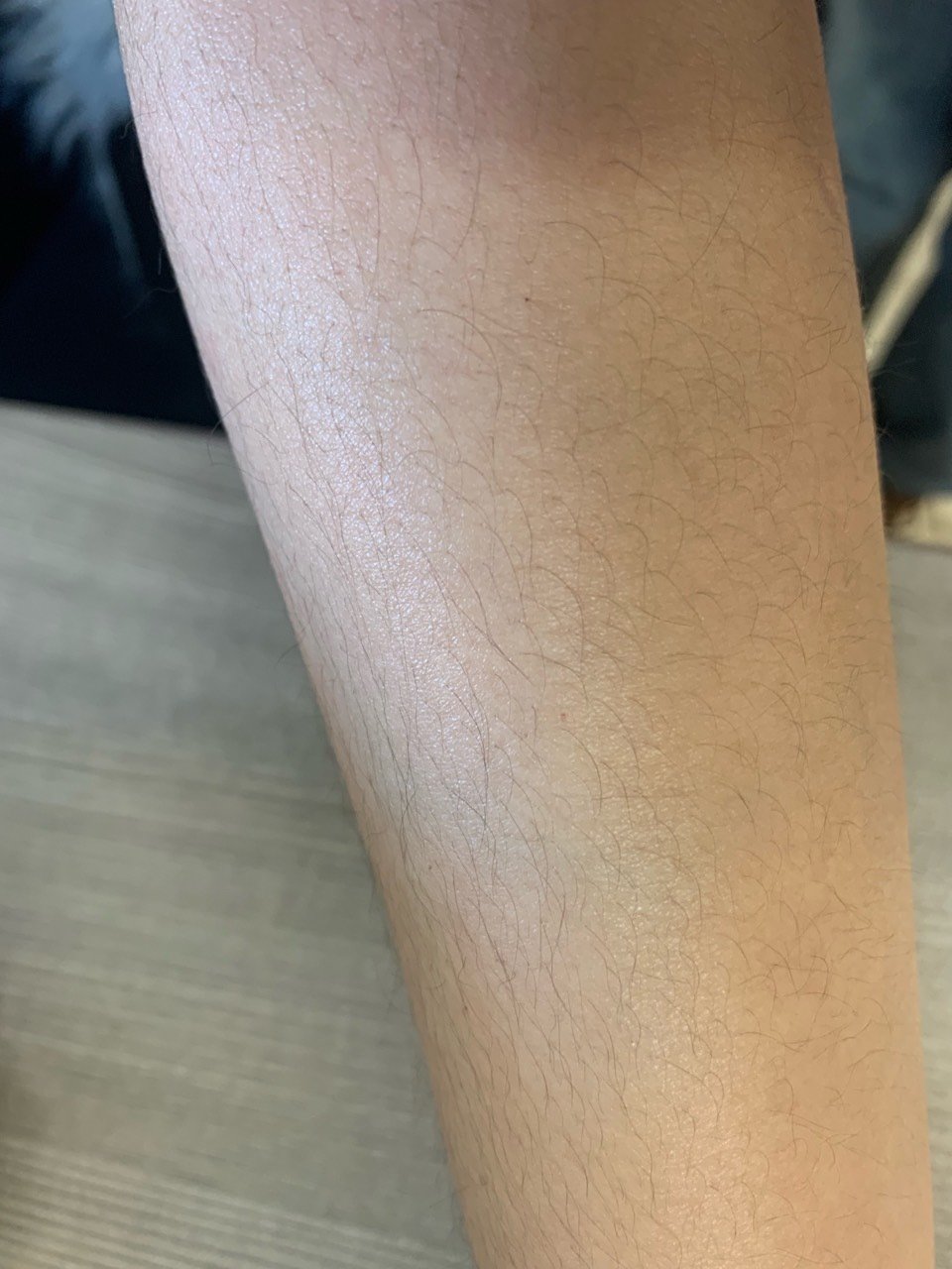 胳膊汗毛图片又密又多手臂汗毛男人腿毛多手臂汗毛重的男人手臂汗毛