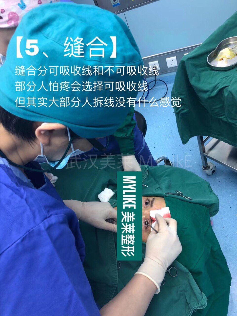 【双眼皮手术过程示意图】双眼皮手术是所有整形项目中_圈子-新氧美容