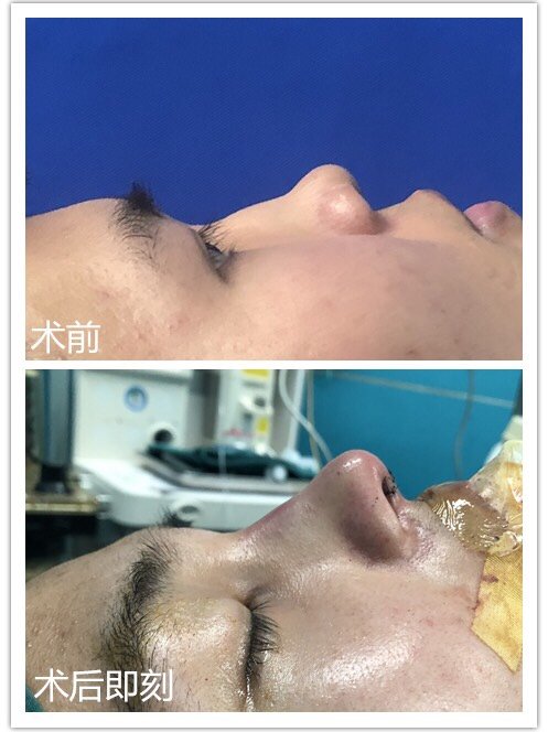 驼峰鼻反而受人追捧?