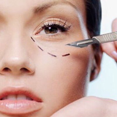 祛眼袋术后如何护理才能快速恢复?