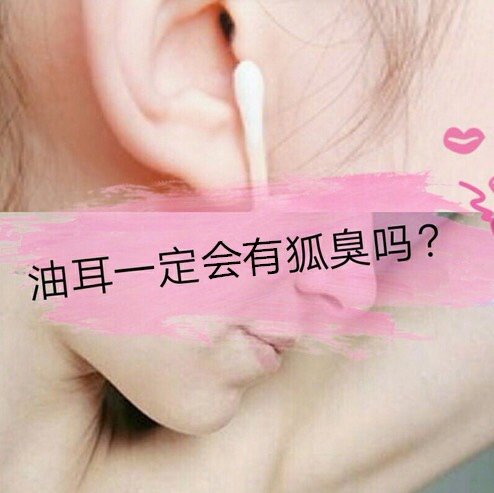 有油耳朵是判断的一个依据,那么有的患者就会问,油耳朵就一定有狐臭吗