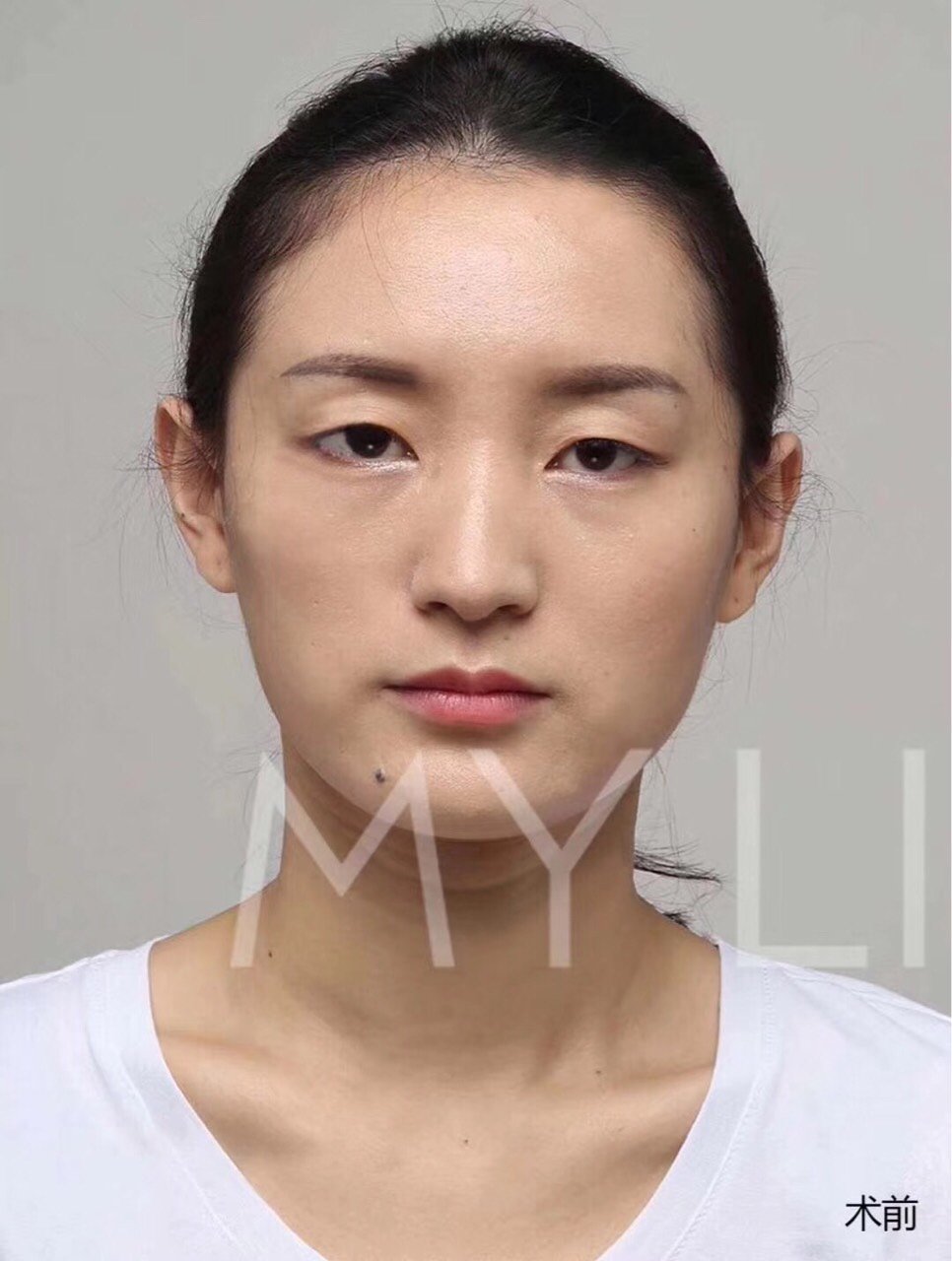 这是什么神仙双眼皮