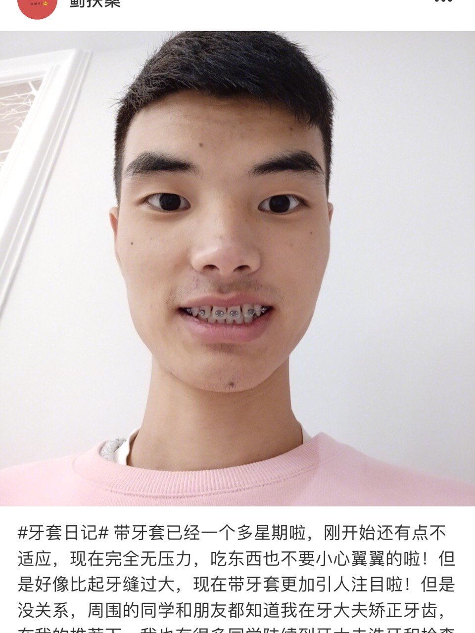 牙齿不整齐对于大多数追求美得人