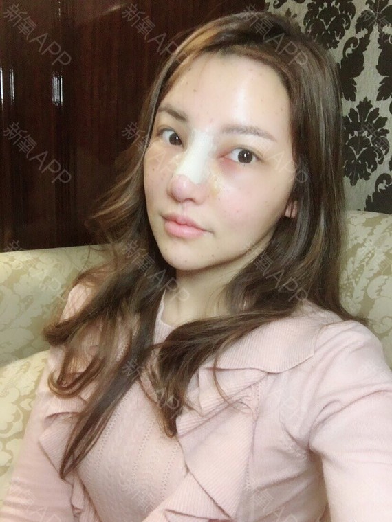 一个鼻子居然能改变一个人的气质?