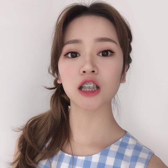 000000传统技术手法滴"钢牙妹"难道就不会让你美丽蜕变吗?