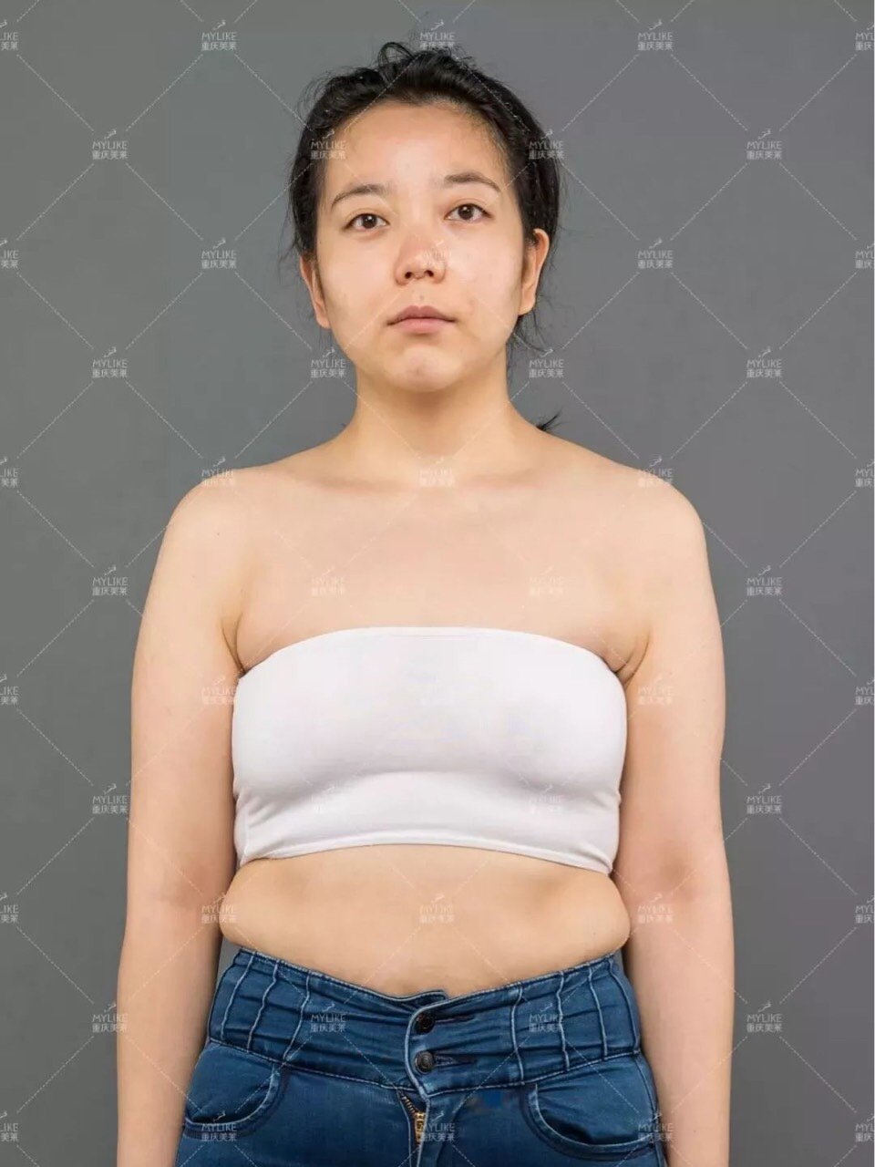 女人40岁乳房下垂图片