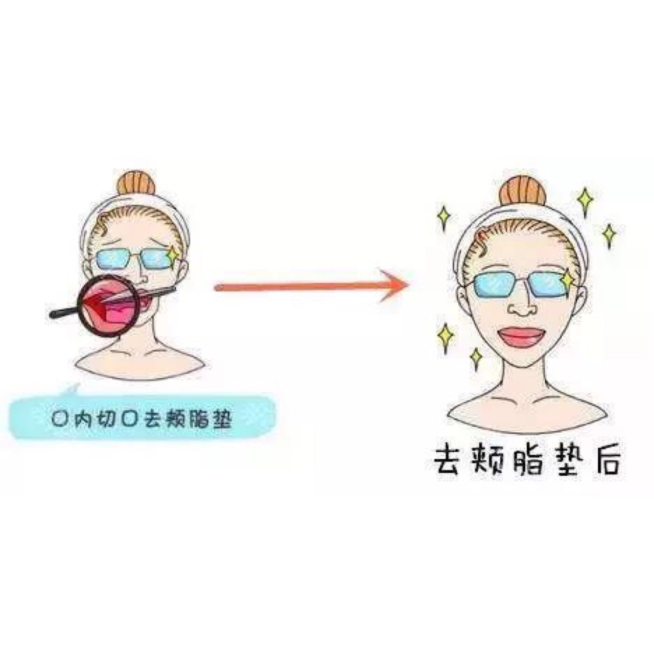 979797大脸变小脸,方法你找的对吗?