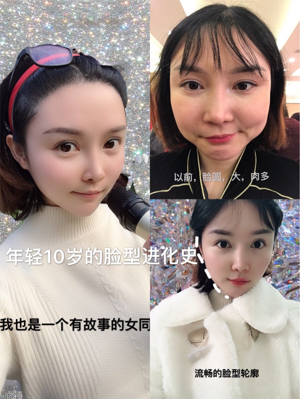 年轻十岁的脸型进化过程 怎么样让 圈子 新氧美容整形