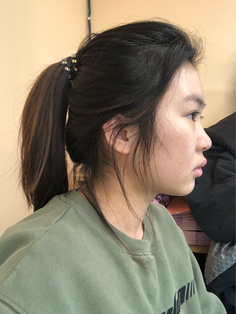 2,我如果做下颔缘吸脂效果会好吗?我想让侧面线条利索一点.