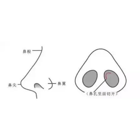 点亮五官的魅力78不止是高一点73什么样的鼻子才好看7191一个